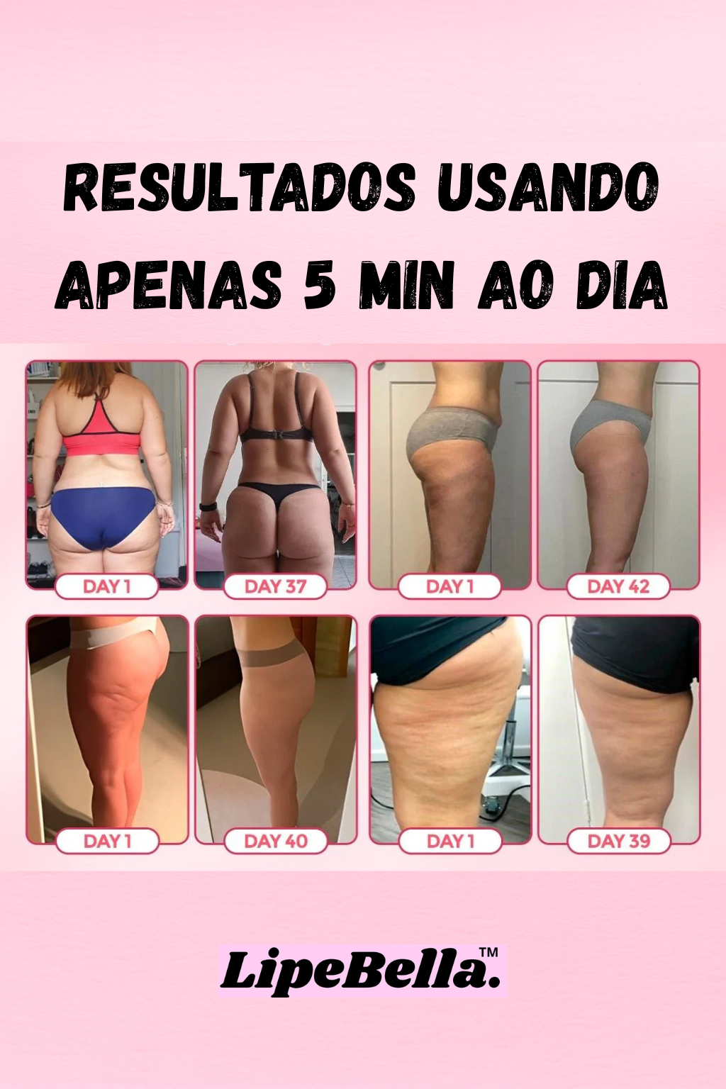 Kit LipeBella™ – Alívio Lipedema